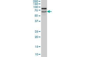 Western Blotting (WB) image for anti-Nucleolar and Coiled-Body Phosphoprotein 1 (NOLC1) (AA 590-700) antibody (ABIN598599) (NOLC1 anticorps  (AA 590-700))