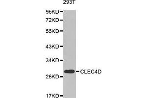 Western blot analysis of extracts of 293T cell line, using CLEC4D antibody. (CLEC4D anticorps  (AA 39-215))