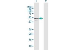 Western Blot analysis of NAPRT1 expression in transfected 293T cell line by NAPRT1 MaxPab polyclonal antibody. (NAPRT1 anticorps  (AA 1-466))