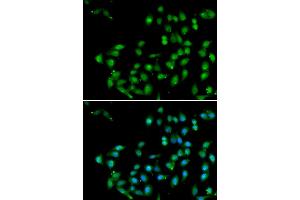 Immunofluorescence analysis of U20S cell using CTNNBL1 antibody. (CTNNBL1 anticorps)