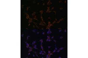 Immunofluorescence analysis of NIH/3T3 cells using DYNLL2 antibody (ABIN6130318, ABIN6139893, ABIN6139895 and ABIN6218049) at dilution of 1:100. (DYNLL2 anticorps  (AA 1-89))