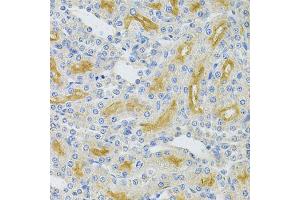 Immunohistochemistry of paraffin-embedded rat kidney using UBE2B Antibody. (UBE2B anticorps)