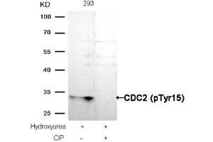 Western blot analysis of extracts from 293 cells, treated with Hydroxyurea or calf intestinal phosphatase (CIP), using CDC2 (Phospho-Tyr15) Antibody. (CDK1 anticorps  (pTyr15))