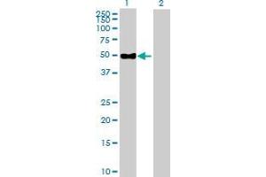 Lane 1: ENPP6 transfected lysate ( 50. (ENPP6 293T Cell Transient Overexpression Lysate(Denatured))