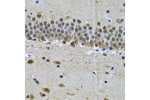 Immunohistochemistry of paraffin-embedded mouse brain using SPIN1 antibody. (Spindlin 1 anticorps  (AA 1-262))