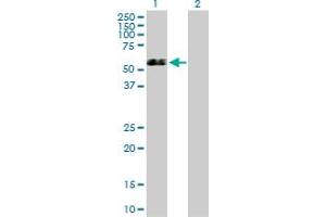 Western Blot analysis of GSR expression in transfected 293T cell line by GSR MaxPab polyclonal antibody. (Glutathione Reductase anticorps  (AA 1-522))