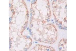 IHC-P analysis of Kidney tissue, with DAB staining. (HSD17B12 anticorps  (AA 1-312))