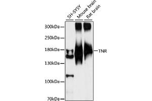 Western blot analysis of extracts of various cell lines, using TNR antibody (ABIN7270766) at 1:1000 dilution. (Tenascin R anticorps  (AA 1059-1358))