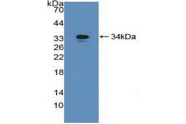 GGT1 anticorps  (AA 296-537)