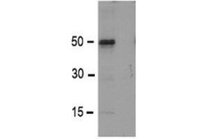 Western Blot using TMPRSS3 antibody. (TMPRSS3 anticorps)