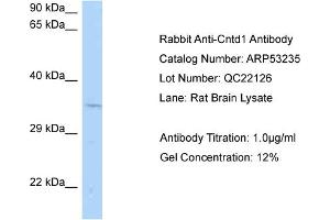 Western Blotting (WB) image for anti-Cyclin N-terminal Domain Containing 1 (CNTD1) (Middle Region) antibody (ABIN2785305) (CNTD1 anticorps  (Middle Region))