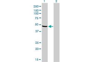 Western Blotting (WB) image for anti-NADH Dehydrogenase (Ubiquinone) Flavoprotein 1, 51kDa (NDUFV1) (AA 365-464) antibody (ABIN518257)