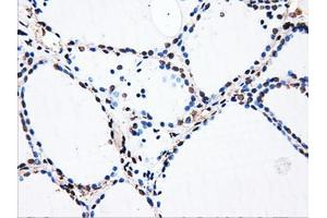 Immunohistochemical staining of paraffin-embedded liver tissue using anti-HDAC10mouse monoclonal antibody. (HDAC10 anticorps)