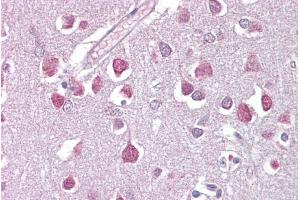 Immunohistochemistry with Brain, cortex tissue at an antibody concentration of 5µg/ml using anti-ETV1 antibody (ARP38528_P050) (ETV1 anticorps  (Middle Region))