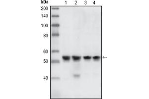 Western blot analysis using CHK1 antibody against HEK293T cells transfected with the pCMV6-ENTRY control (1) and pCMV6-ENTRY CHK1 cDNA (2). (CHEK1 anticorps)