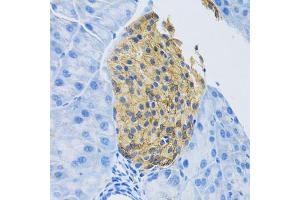 Immunohistochemistry of paraffin-embedded mouse pancreas using SLC1A2 antibody (ABIN5995519) at dilution of 1/100 (40x lens). (SLC1A2 anticorps)