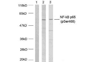 Western blot analysis of extracts using NF-κB p65 (phospho-Ser468) antibody (E011013). (NF-kB p65 anticorps  (pSer468))