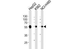 Lane 1: HepG2 Cell lysates, Lane 2: K562 Cell lysates, Lane 3: NCI-H460 Cell lysates, probed with ALDH1A1 (152CT1. (ALDH1A1 anticorps)