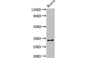 Western Blot Positive WB detected in: Mouse brain tissue All lanes: Cd74 antibody at 3 μg/mL Secondary Goat polyclonal to rabbit IgG at 1/50000 dilution Predicted band size: 32, 25 kDa Observed band size: 32 kDa (CD74 anticorps  (AA 56-279))