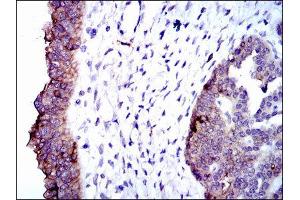 Immunohistochemistry (IHC) image for anti-Alkaline Phosphatase, Liver/bone/kidney (ALPL) antibody (ABIN1845845) (ALPL anticorps)