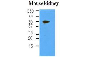 The extracts of mouse kidney (50 ug) were resolved by SDS-PAGE, transferred to nitrocellulose membrane and probed with anti-human PDPN (1:500). (Podoplanin anticorps  (AA 1-206))