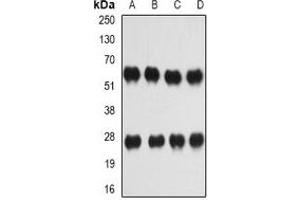 Western blot analysis of IL-27 expression in Hela (A), HepG2 (B), mouse spleen (C), mouse liver (D) whole cell lysates. (IL-27 anticorps)