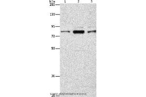 Western blot analysis of Human brain malignant glioma tissue, A172 and 293T cell, using ARHGEF7 Polyclonal Antibody at dilution of 1:800 (ARHGEF7 anticorps)
