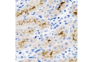Immunohistochemical analysis of SET staining in mouse kidney formalin fixed paraffin embedded tissue section. (SET/TAF-I anticorps)