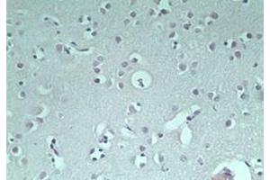 Image no. 1 for anti-Ring Finger Protein 128 (RNF128) (AA 227-253) antibody (ABIN207733) (RNF128 anticorps  (AA 227-253))