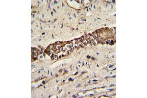 Formalin-fixed and paraffin-embedded human normal lung with TYRO10 Antibody, which was peroxidase-conjugated to the secondary antibody, followed by DAB staining. (DDR2 anticorps)