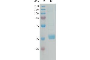 Human M Protein, His Tag on SDS-PAGE under reducing condition. (MFAP4 Protein (AA 22-255) (His tag))