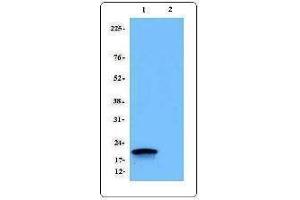 Western Blotting (WB) image for anti-CD247 Molecule (CD247) antibody (ABIN2664433) (CD247 anticorps)