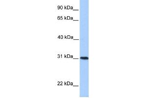WB Suggested Anti-HELT Antibody Titration:  0. (HELT anticorps  (Middle Region))