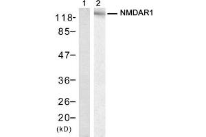 Western blot analysis of extract from mouse brain tissue, using NMDAR1 (Ab-896) Antibody (E021133, Lane 1 and 2). (GRIN1/NMDAR1 anticorps)