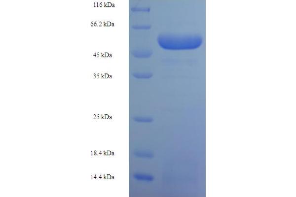 SART3 Protein (AA 600-900, partial) (His-SUMO Tag)