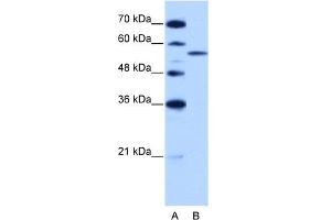 WB Suggested Anti-ZRSR2 Antibody Titration:  2. (ZRSR2 anticorps  (C-Term))