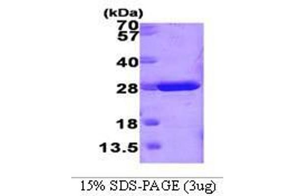 GSTM1 Protein (AA 1-218)