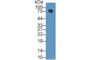 Detection of zAP70 in Mouse Thymus lysate using Polyclonal Antibody to Zeta Chain Associated Protein Kinase 70 kDa (zAP70) (ZAP70 anticorps  (AA 270-560))