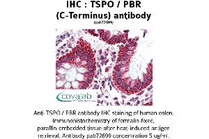 Image no. 2 for anti-Peripheral-Type Benzodiazepine Receptor (TSPO) (C-Term) antibody (ABIN1740430) (TSPO anticorps  (C-Term))