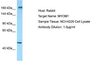 Host: RabbitTarget Name: MYOM1Antibody Dilution: 1. (Myomesin 1 anticorps  (C-Term))