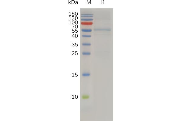 TIMP4 Protein (AA 30-224) (Fc Tag)