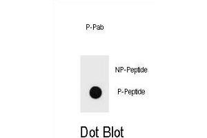 Dot blot analysis of Phospho-KIT- Antibody Phospho-specific Pab g on nitrocellulose membrane. (KIT anticorps  (pThr718))