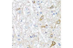 Immunohistochemistry of paraffin-embedded rat brain using SERPINA7 antibody. (SERPINA7 anticorps)