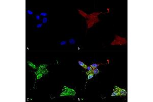 Immunocytochemistry/Immunofluorescence analysis using Mouse Anti-TrpM7 Monoclonal Antibody, Clone S74 (ABIN2483105). (TRPM7 anticorps  (AA 1817-1863) (Atto 488))