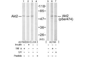 Image no. 2 for anti-V-Akt Murine Thymoma Viral Oncogene Homolog 2 (AKT2) (Ser474) antibody (ABIN197359) (AKT2 anticorps  (Ser474))