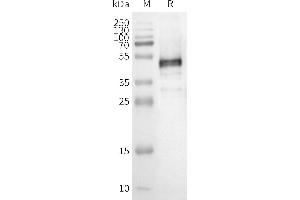 WB analysis of Human OR1E1-Nanodisc with anti-Flag monoclonal antibody at 1/5000 dilution, followed by Goat Anti-Rabbit IgG HRP at 1/5000 dilution (OR1E1 Protéine)