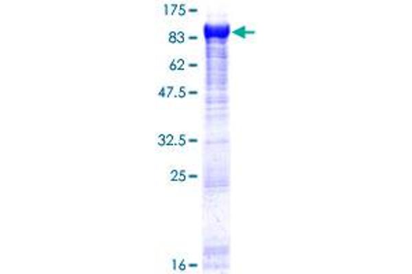 GARS Protein (AA 1-685) (GST tag)