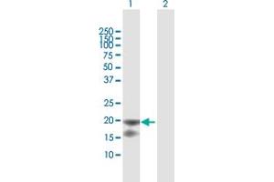 Western Blot analysis of IL1RN expression in transfected 293T cell line by IL1RN MaxPab polyclonal antibody. (IL1RN anticorps  (AA 1-177))
