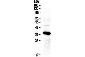 Western blot analysis of IGFBP2 using anti-IGFBP2 antibody . (IGFBP2 anticorps  (AA 36-325))