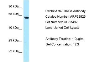 Western Blotting (WB) image for anti-Transforming Growth Factor beta Regulator 4 (TBRG4) (N-Term) antibody (ABIN971851) (TBRG4 anticorps  (N-Term))